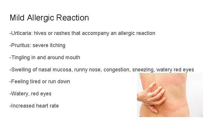 Mild Allergic Reaction -Urticaria: hives or rashes that accompany an allergic reaction -Pruritus: severe