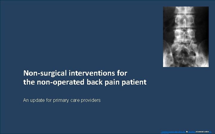 Non-surgical interventions for the non-operated back pain patient An update for primary care providers