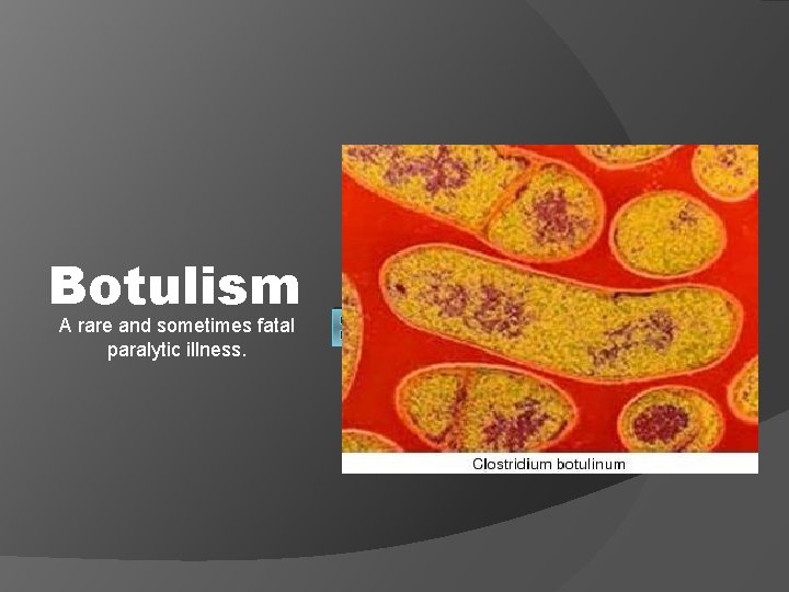 Botulism A rare and sometimes fatal paralytic illness. BOTULISM 