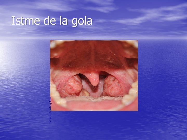 Istme de la gola by Klem Istme de la gola Istme de la gola by Klem Istme de la gola