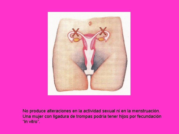 No produce alteraciones en la actividad sexual ni en la menstruación. Una mujer con