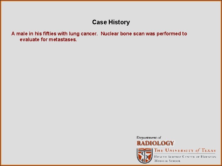 Case History A male in his fifties with lung cancer. Nuclear bone scan was