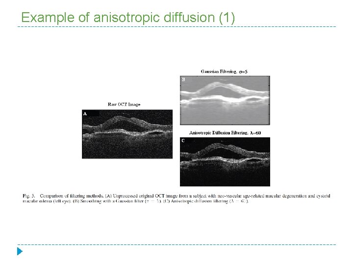 Example of anisotropic diffusion (1) 