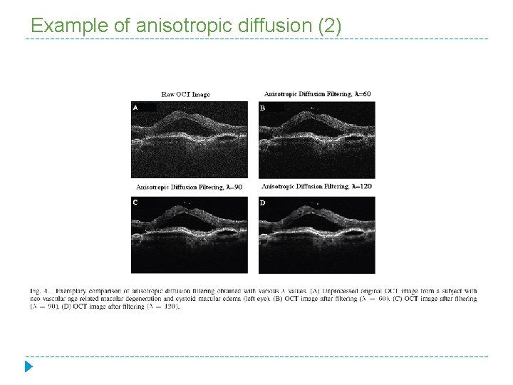 Example of anisotropic diffusion (2) 
