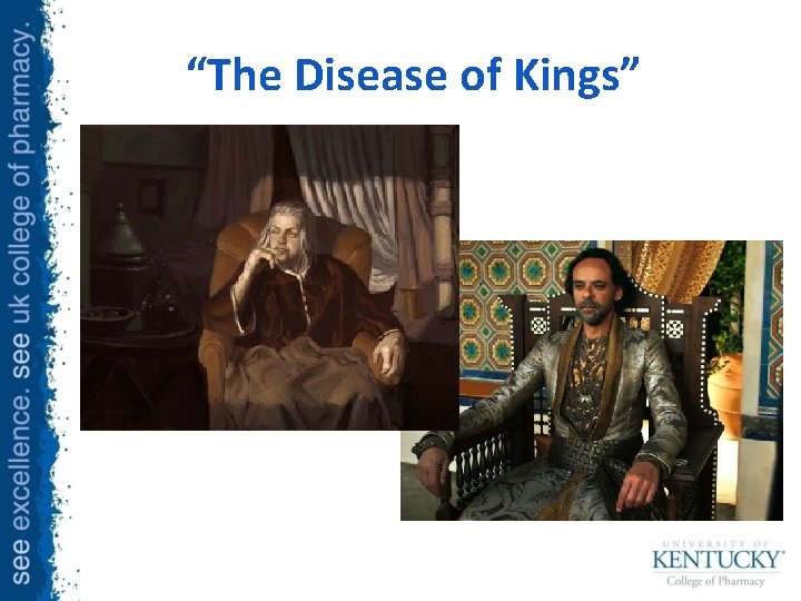 “The Disease of Kings” 