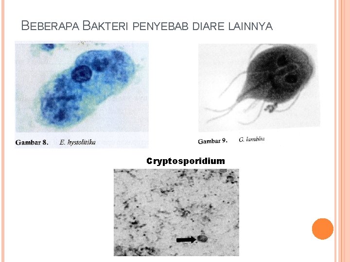 BEBERAPA BAKTERI PENYEBAB DIARE LAINNYA Cryptosporidium 