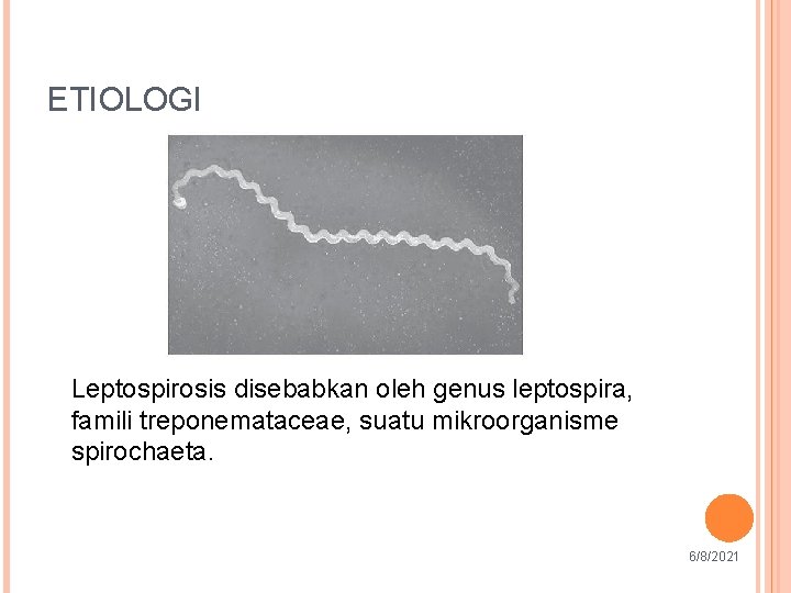ETIOLOGI Leptospirosis disebabkan oleh genus leptospira, famili treponemataceae, suatu mikroorganisme spirochaeta. 4 6 6/8/2021