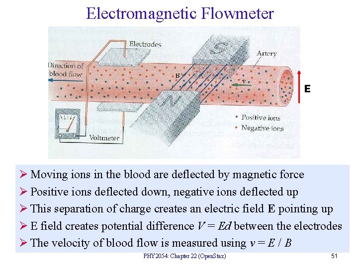 Electromagnetic Flowmeter E Ø Moving ions in the blood are deflected by magnetic force