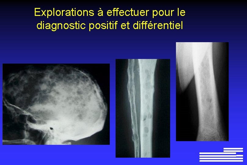 Explorations à effectuer pour le diagnostic positif et différentiel 