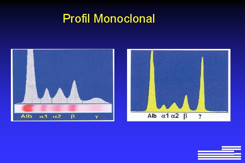 Profil Monoclonal 