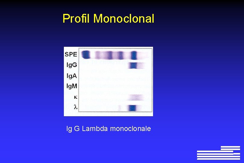 Profil Monoclonal Ig G Lambda monoclonale 
