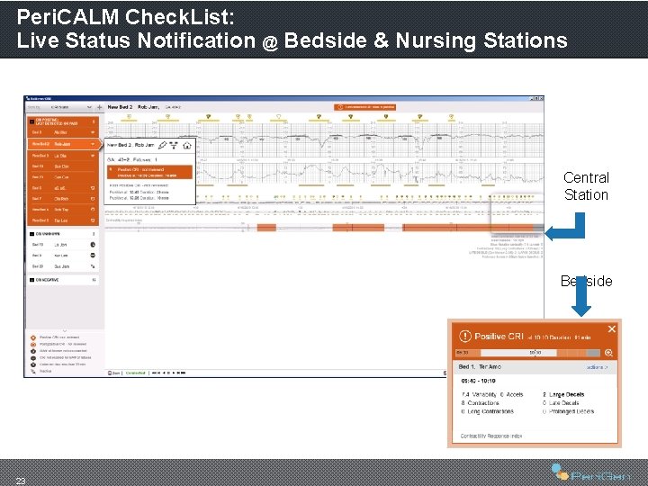 Peri. CALM Check. List: Live Status Notification @ Bedside & Nursing Stations Central Station