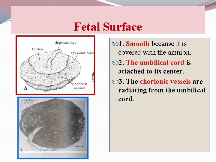 Fetal Surface 1. Smooth because it is covered with the amnion. 2. The umbilical