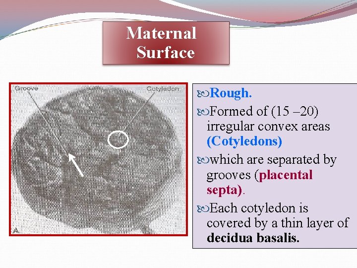 Maternal Surface Rough. Formed of (15 – 20) irregular convex areas (Cotyledons) which are