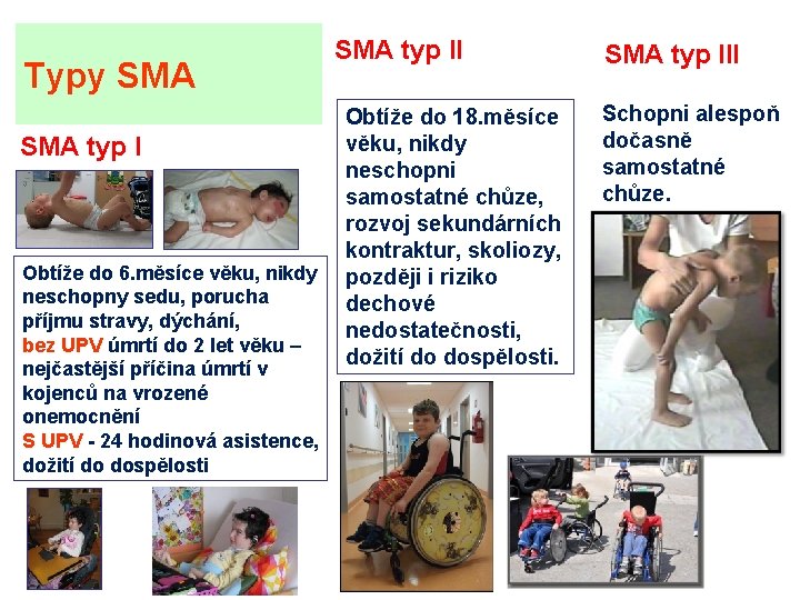 Typy SMA typ I Obtíže do 6. měsíce věku, nikdy neschopny sedu, porucha příjmu