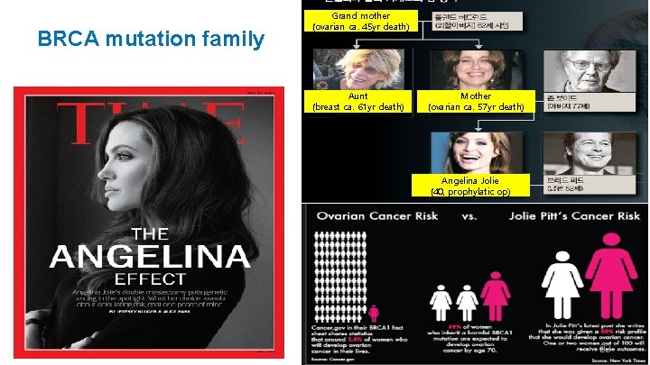 BRCA mutation family Grand mother (ovarian ca. 45 yr death) Aunt (breast ca. 61
