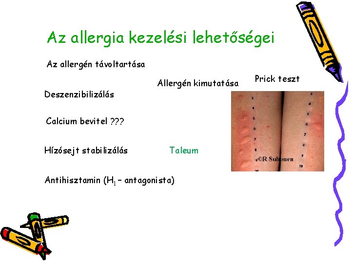 Az allergia kezelési lehetőségei Az allergén távoltartása Deszenzibilizálás Allergén kimutatása Calcium bevitel ? ?