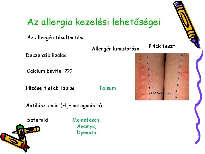 Az allergia kezelési lehetőségei Az allergén távoltartása Allergén kimutatása Deszenzibilizálás Calcium bevitel ? ?