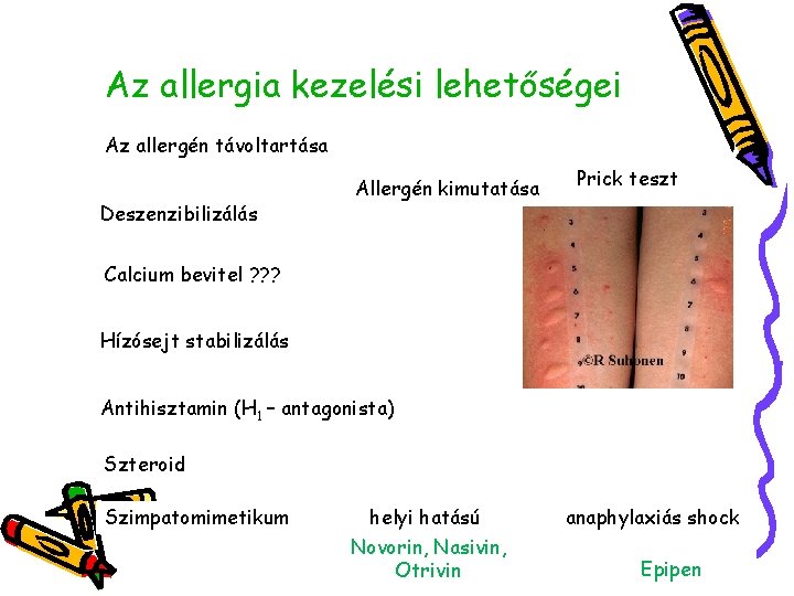 Az allergia kezelési lehetőségei Az allergén távoltartása Deszenzibilizálás Allergén kimutatása Prick teszt Calcium bevitel