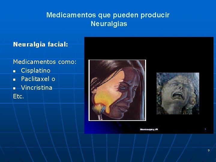 Medicamentos que pueden producir Neuralgias Neuralgia facial: Medicamentos como: n Cisplatino n Paclitaxel o