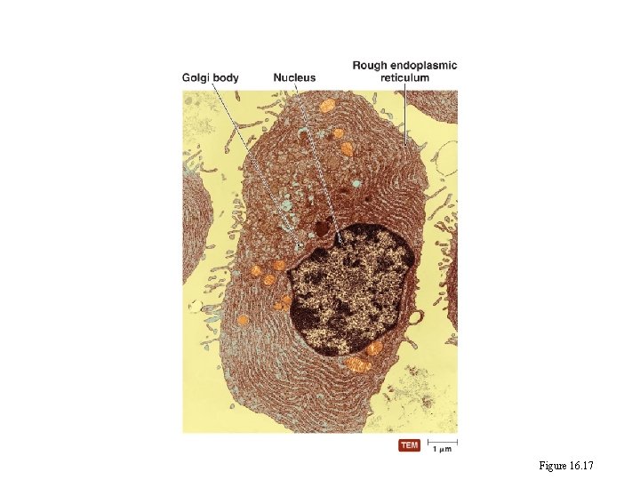 A plasma cell Figure 16. 17 