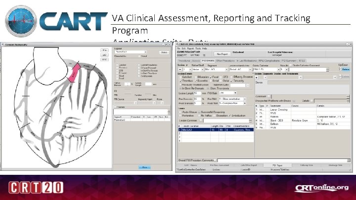 VA Clinical Assessment, Reporting and Tracking Program Application Suite, Data 