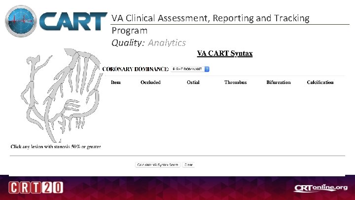 VA Clinical Assessment, Reporting and Tracking Program Quality: Analytics 