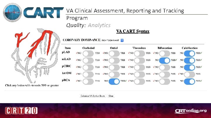 VA Clinical Assessment, Reporting and Tracking Program Quality: Analytics 