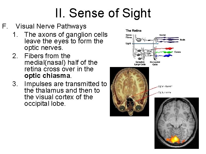 II. Sense of Sight F. Visual Nerve Pathways 1. The axons of ganglion cells