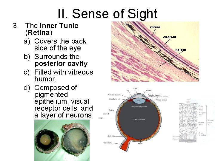II. Sense of Sight 3. The Inner Tunic (Retina) a) Covers the back side