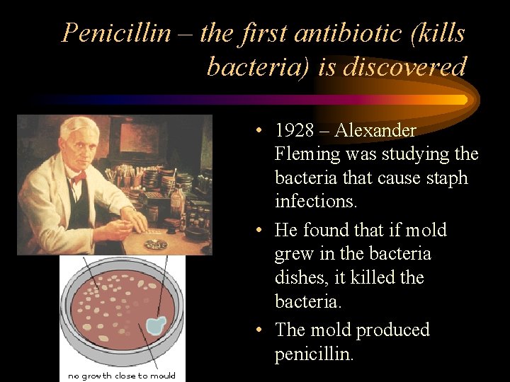 Penicillin – the first antibiotic (kills bacteria) is discovered • 1928 – Alexander Fleming