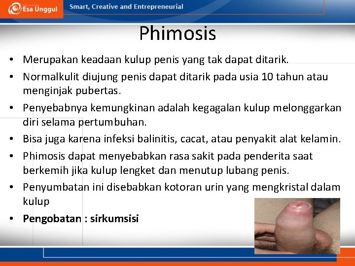 Phimosis • Merupakan keadaan kulup penis yang tak dapat ditarik. • Normalkulit diujung penis Phimosis • Merupakan keadaan kulup penis yang tak dapat ditarik. • Normalkulit diujung penis