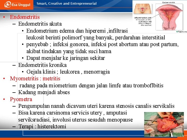  • Endometritis – Endometritis akuta • Endometrium edema dan hiperemi , infiltrasi leukosit