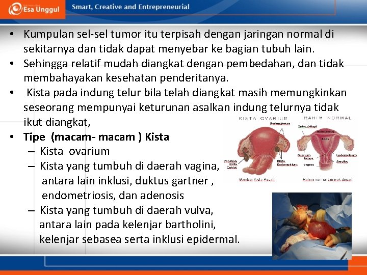  • Kumpulan sel-sel tumor itu terpisah dengan jaringan normal di sekitarnya dan tidak