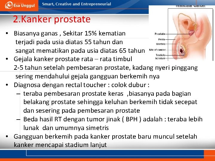 2. Kanker prostate • Biasanya ganas , Sekitar 15% kematian terjadi pada usia diatas 2. Kanker prostate • Biasanya ganas , Sekitar 15% kematian terjadi pada usia diatas