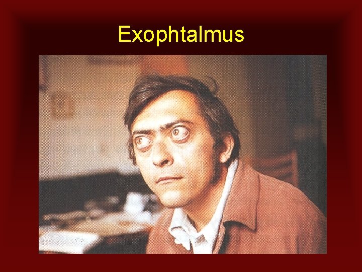 Exophtalmus 