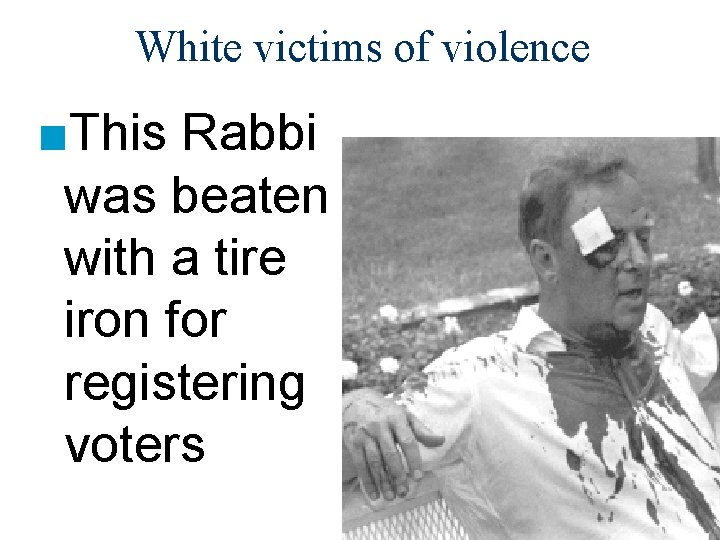 White victims of violence ■This Rabbi was beaten with a tire iron for registering