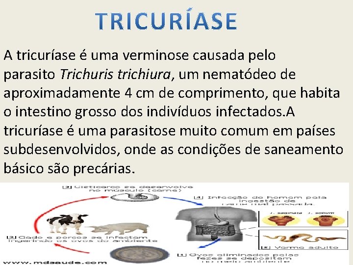 A tricuríase é uma verminose causada pelo parasito Trichuris trichiura, um nematódeo de aproximadamente