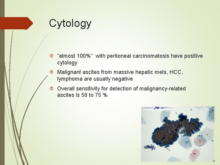 Cytology “almost 100%” with peritoneal carcinomatosis have positive cytology Malignant ascites from massive hepatic Cytology “almost 100%” with peritoneal carcinomatosis have positive cytology Malignant ascites from massive hepatic