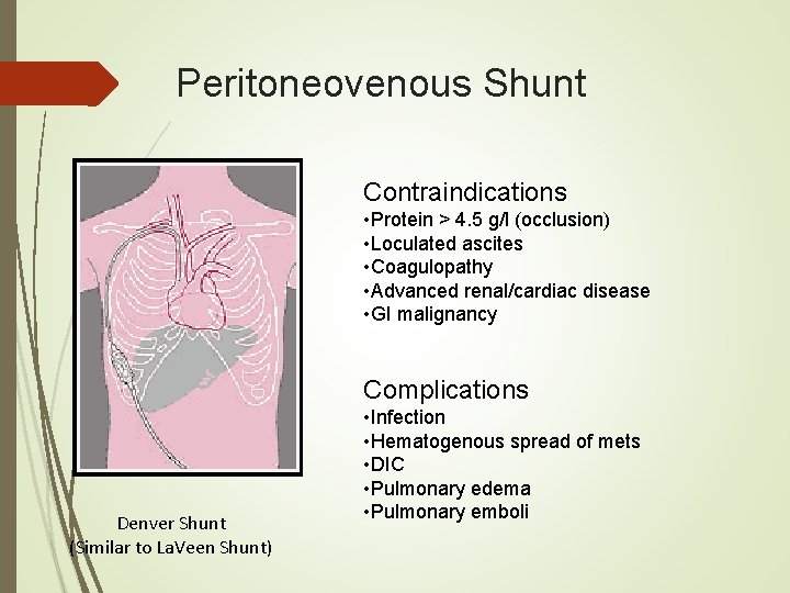 Peritoneovenous Shunt Contraindications • Protein > 4. 5 g/l (occlusion) • Loculated ascites • Peritoneovenous Shunt Contraindications • Protein > 4. 5 g/l (occlusion) • Loculated ascites •