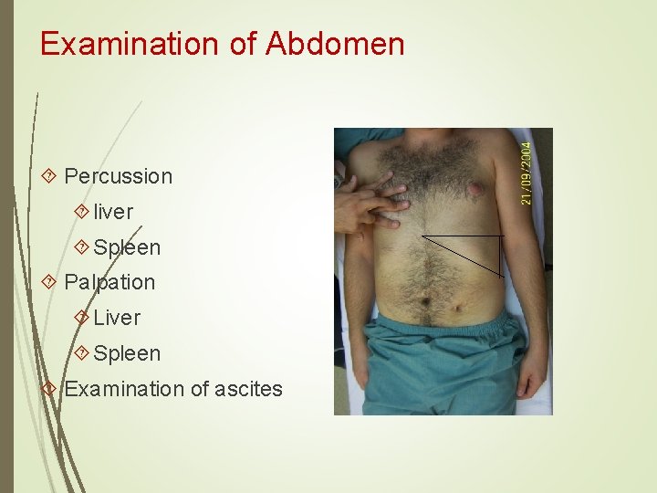 Examination of Abdomen Percussion liver Spleen Palpation Liver Spleen Examination of ascites Examination of Abdomen Percussion liver Spleen Palpation Liver Spleen Examination of ascites