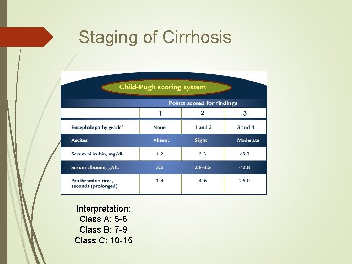 Staging of Cirrhosis Interpretation: Class A: 5 -6 Class B: 7 -9 Class C: Staging of Cirrhosis Interpretation: Class A: 5 -6 Class B: 7 -9 Class C: