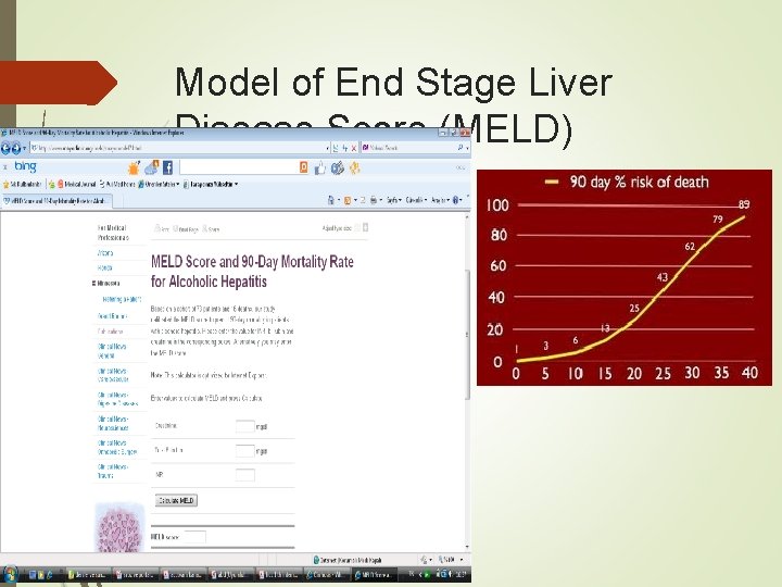 Model of End Stage Liver Disease Score (MELD) Model of End Stage Liver Disease Score (MELD)