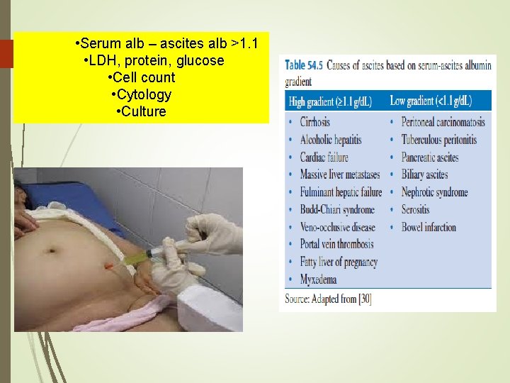 • Serum alb – ascites alb >1. 1 • LDH, protein, glucose • • Serum alb – ascites alb >1. 1 • LDH, protein, glucose •