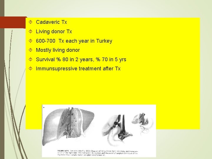 Cadaveric Tx Living donor Tx 600 -700 Tx each year in Turkey Mostly Cadaveric Tx Living donor Tx 600 -700 Tx each year in Turkey Mostly