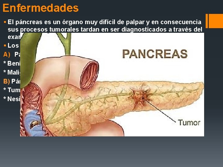 Enfermedades § El páncreas es un órgano muy difícil de palpar y en consecuencia