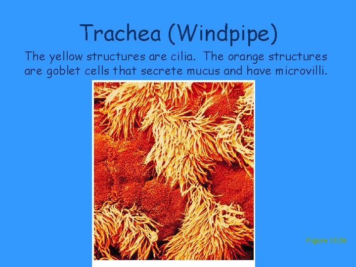 Trachea (Windpipe) The yellow structures are cilia. The orange structures are goblet cells that Trachea (Windpipe) The yellow structures are cilia. The orange structures are goblet cells that