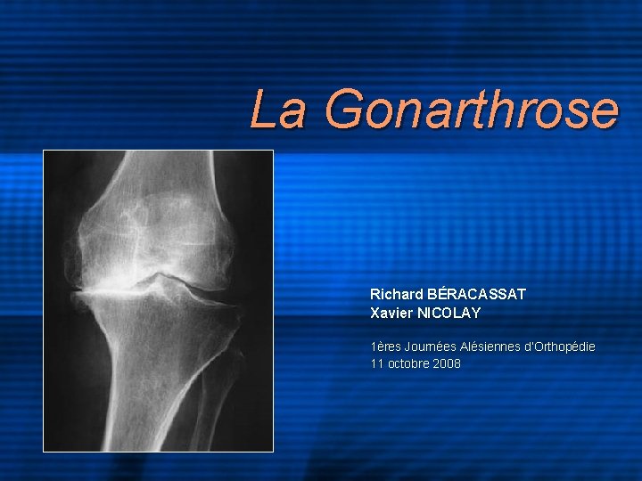 La Gonarthrose Richard BÉRACASSAT Xavier NICOLAY 1ères Journées Alésiennes d’Orthopédie 11 octobre 2008 