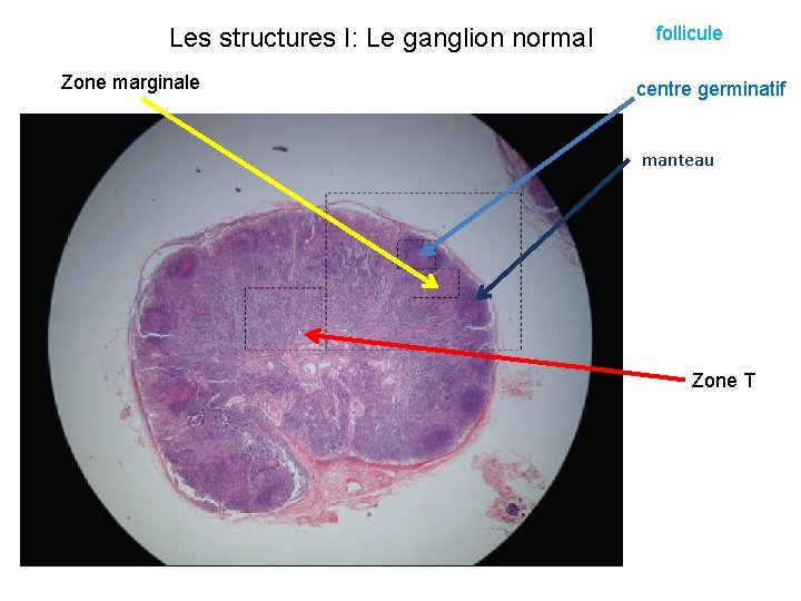 Les structures I: Le ganglion normal Zone marginale follicule centre germinatif manteau Zone T