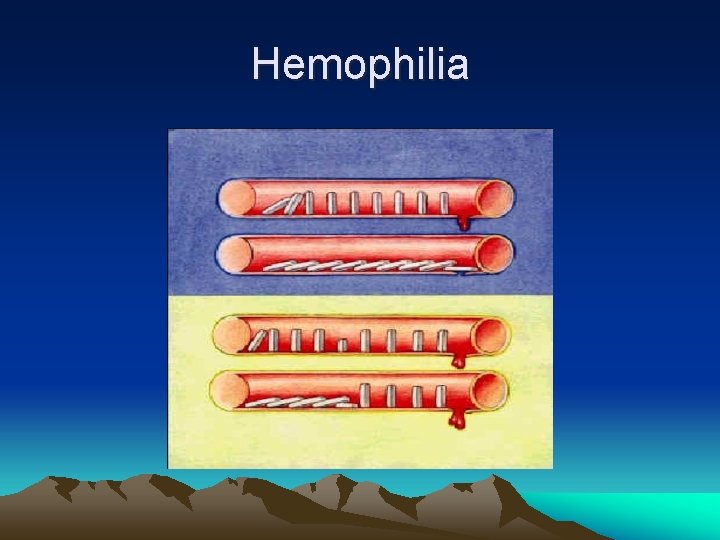 Hemophilia 